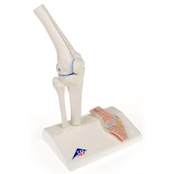 Anatomie Modell Kniegelenk Mini  mit Querschnitt
