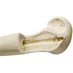 Elle rechts, (Ulna), ORTHObones Premium / Bild 2