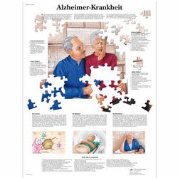 Lehrtafel - Alzheimer-Krankheit