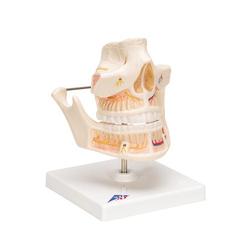 Gebissmodell eines Erwachsenen - 3B Smart Anatomy / Bild 2