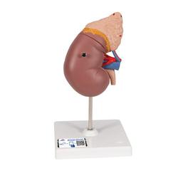 Nierensteinmodell - 3B Smart Anatomy