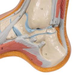 Fussmodell Hohlfuss (Pes cavus) - 3B Smart Anatomy / Bild 7