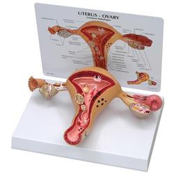 Uterus Modell