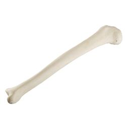 Schienbein Tibia rechts ORTHObones Standard