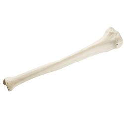 Schienbein Tibia rechts ORTHObones Standard / Bild 3