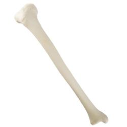 Schienbein Tibia rechts ORTHObones Standard / Bild 4