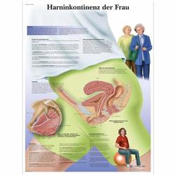 Lehrtafel - Harninkontinenz der Frau 