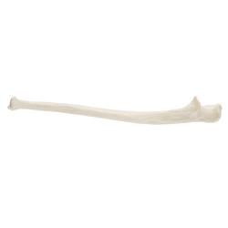 Elle, Ulna, links, ORTHObones Standard / Bild 2