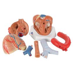 Herzmodell 7-teilig - 3B Smart Anatomy / Bild 3