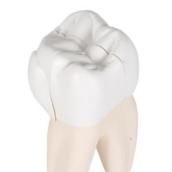 Oberer dreiwurzeliger Molar, 3- teilig / Bild 8