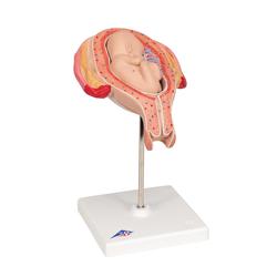 Fetus Modell 5. Monat Steisslage - 3B Smart Anatomy / Bild 2