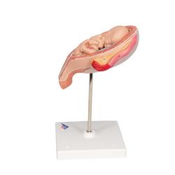 Fetus Modell 5. Monat Steisslage - 3B Smart Anatomy / Bild 5