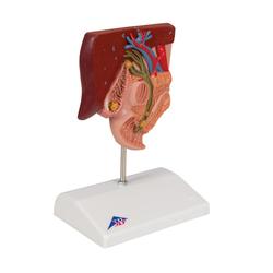 Gallensteinmodell - 3B Smart Anatomy / Bild 2