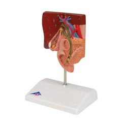 Gallensteinmodell - 3B Smart Anatomy / Bild 5