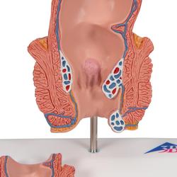 Hämorrhoidenmodell - 3B Smart Anatomy / Bild 8