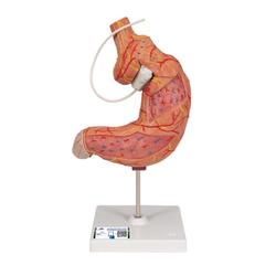 Magenbandmodell - 3B Smart Anatomy