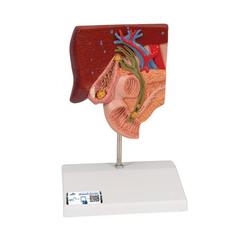 Gallensteinmodell - 3B Smart Anatomy