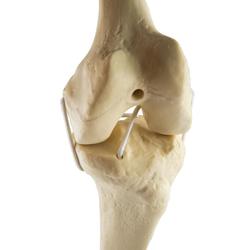 Knie links, ORTHObones Standard / Bild 3