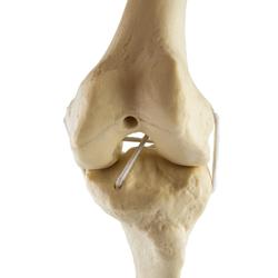 Knie links, ORTHObones Standard / Bild 5