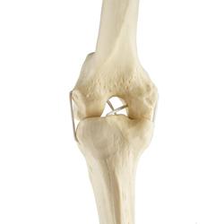 Knie links, ORTHObones Standard / Bild 6