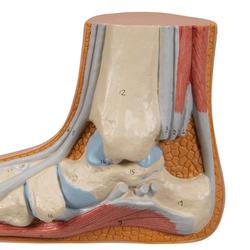 Fussmodell Plattfuss (Pes planus) - 3B Smart Anatomy / Bild 7