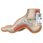 Fussmodell Hohlfuss (Pes cavus) - 3B Smart Anatomy / Bild 1