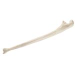 Elle, Ulna, rechts ORTHObones Standard / Bild 1