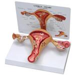 Uterus Modell / Bild 1