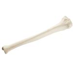 Schienbein Tibia rechts ORTHObones Standard / Bild 3