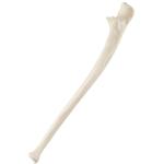 Elle, Ulna, links, ORTHObones Standard / Bild 1