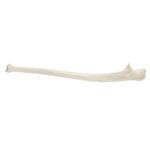 Elle, Ulna, links, ORTHObones Standard / Bild 2