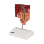 Gallensteinmodell - 3B Smart Anatomy / Bild 5