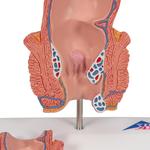 Hämorrhoidenmodell - 3B Smart Anatomy / Bild 8