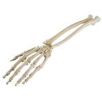 Hand & Handgelenk, ORTHObones Standard / Bild 1