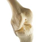 Knie links, ORTHObones Standard / Bild 1