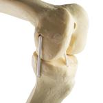 Knie links, ORTHObones Standard / Bild 2