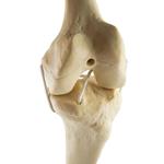 Knie links, ORTHObones Standard / Bild 3