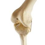 Knie links, ORTHObones Standard / Bild 4