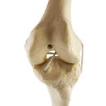 Knie links, ORTHObones Standard / Bild 5