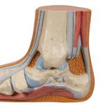 Fussmodell Plattfuss (Pes planus) - 3B Smart Anatomy / Bild 7